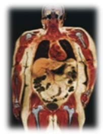 Risonanza magnetica